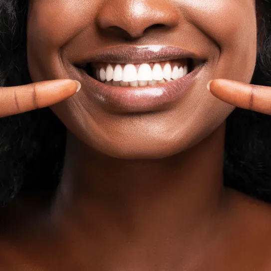 24916 in office teeth whitening