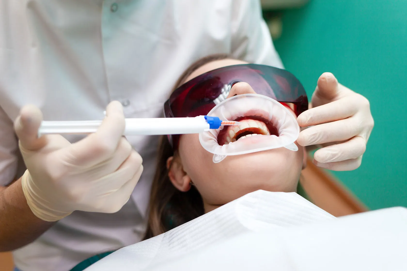 24916 teeth discoloration causes