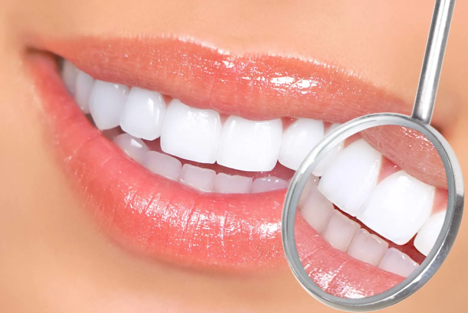 24919 at home teeth whitening