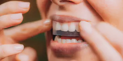 /img/24919-healthy-smile.webp