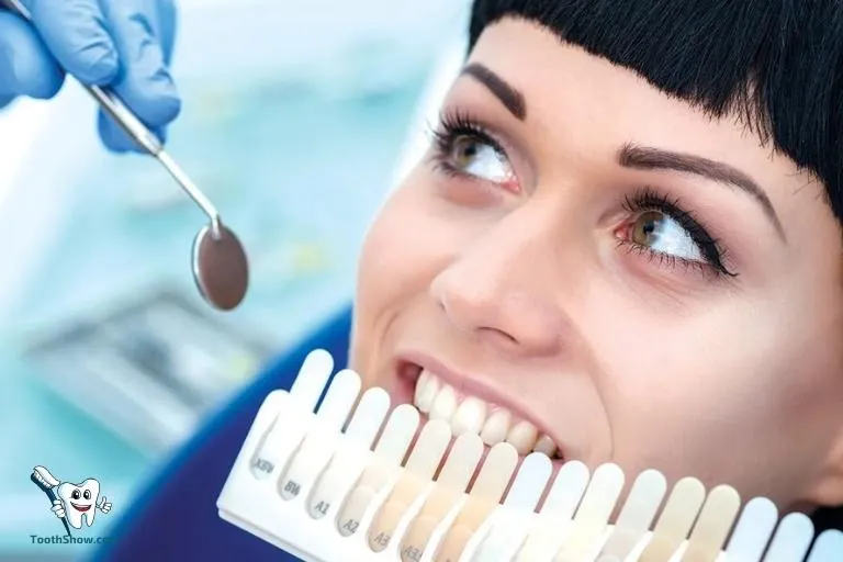 24919 whitening strips gels