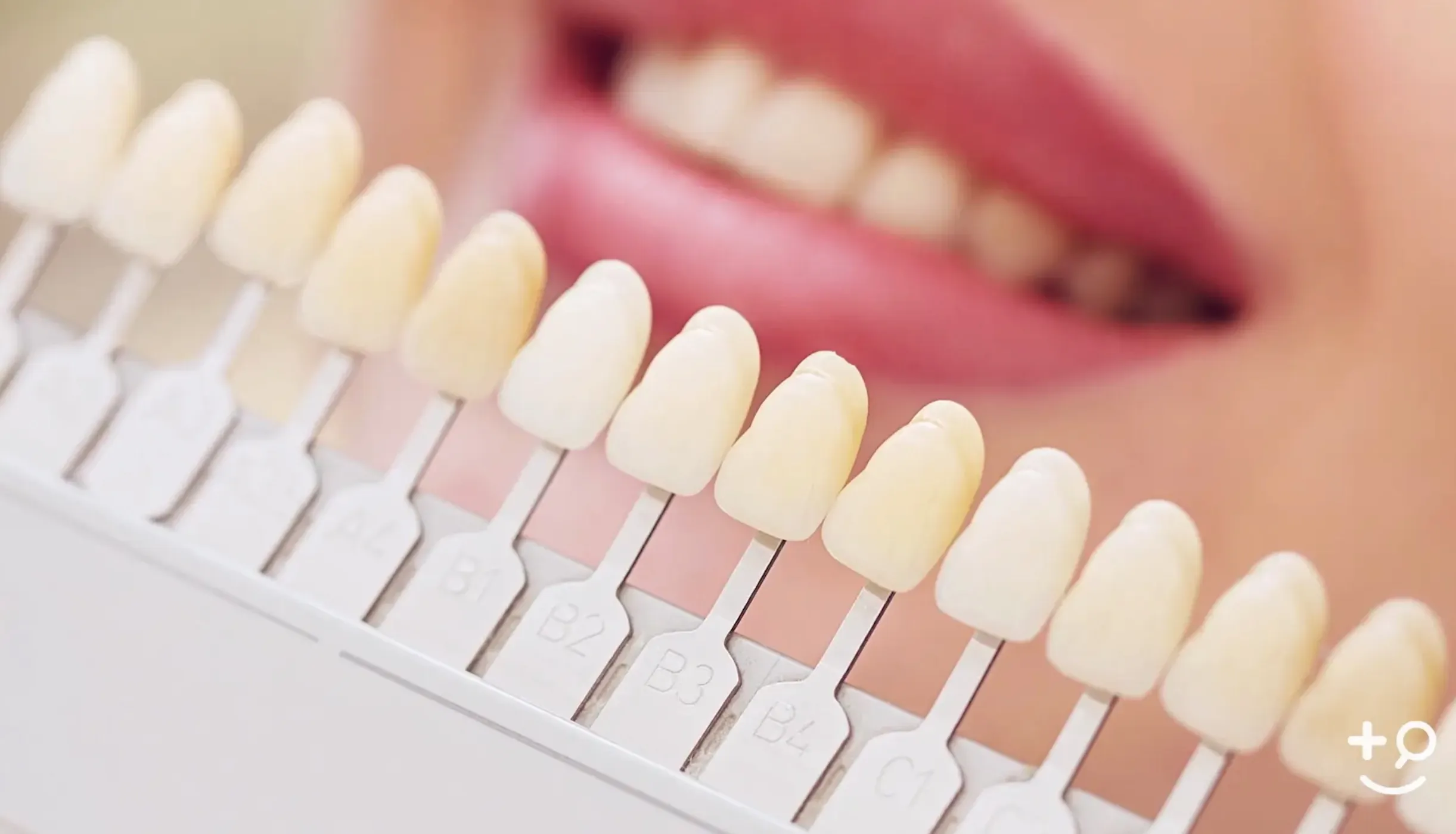 24925 teeth whitening maintenance