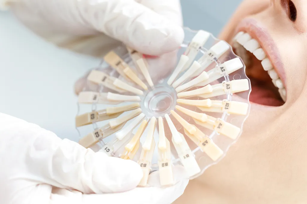 24929 welland teeth whitening 1