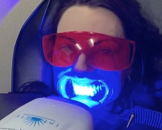 24933 teeth whitening gilbert az image1
