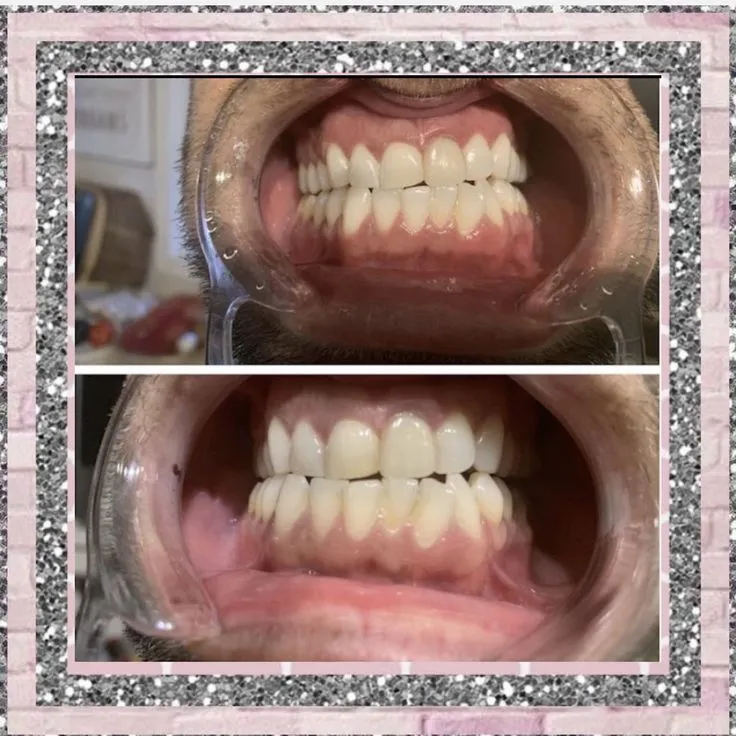 /img/24935-teeth-whitening-products.webp