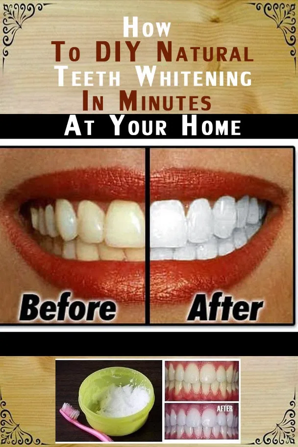 24936 brushing flossing