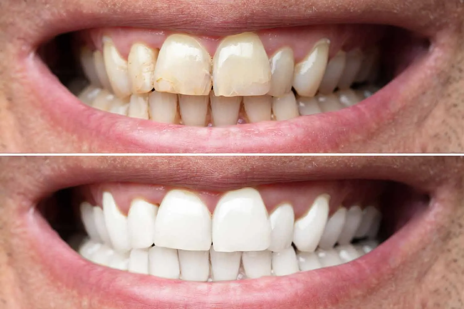24940 oral hygiene