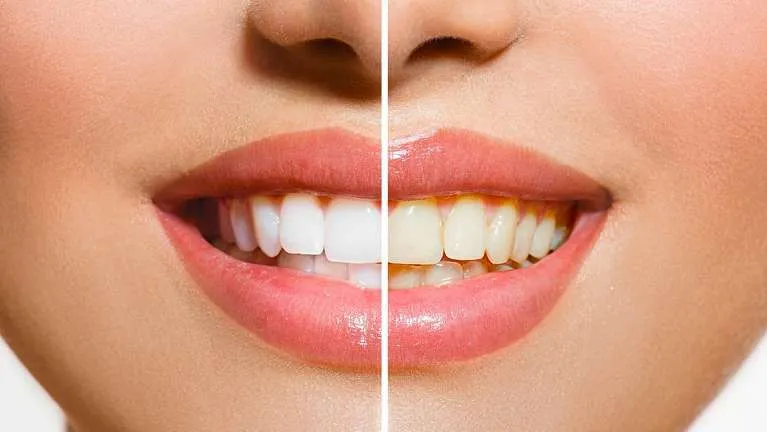 24940 teeth sensitivity