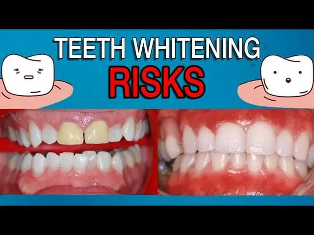 24940 whitening agents