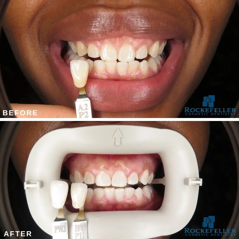 24941 whitening toothpaste