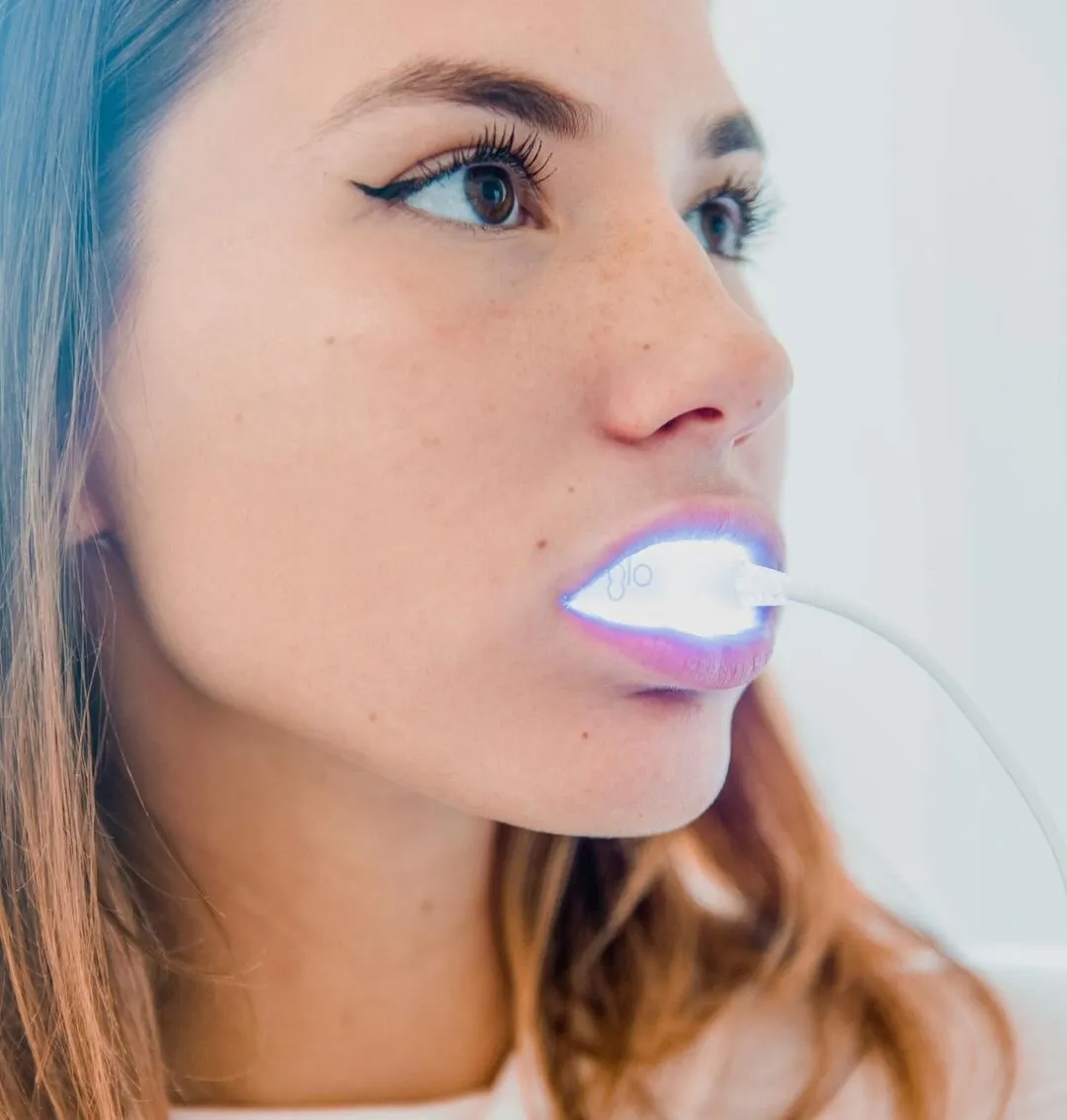 24943 teeth whitening bangor me dentist
