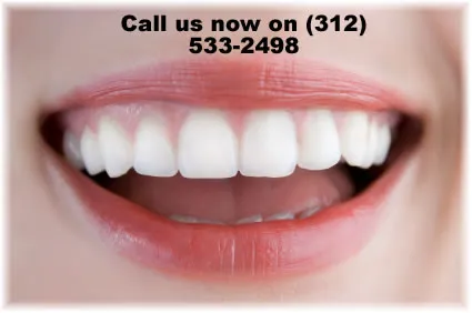 /img/24944-teeth-whitening-chicago-il-image7.webp