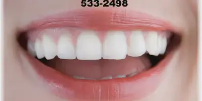 /img/24944-teeth-whitening-chicago-il-image7.webp