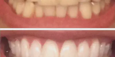 /img/24945-dental-checkups.webp