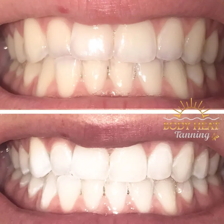 24945 oral hygiene routine