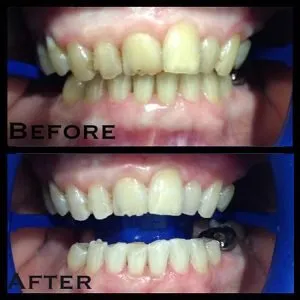 24948 dental hygiene