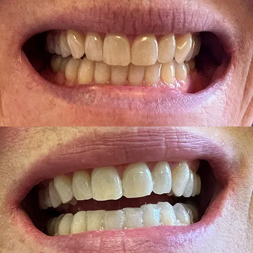 /img/24950-dentist-advice.webp