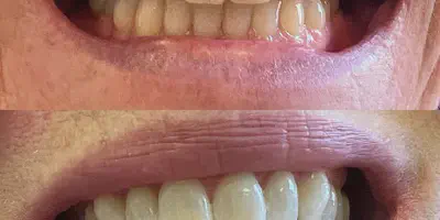 /img/24950-dentist-advice.webp