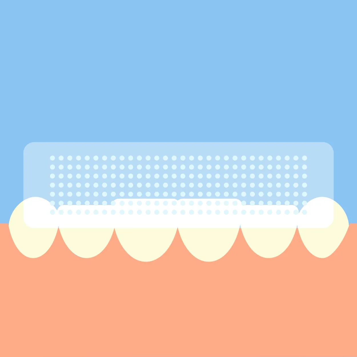 24964 plaque on teeth