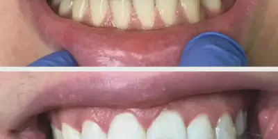 /img/24965-teeth-whitening-cost-dudley.webp