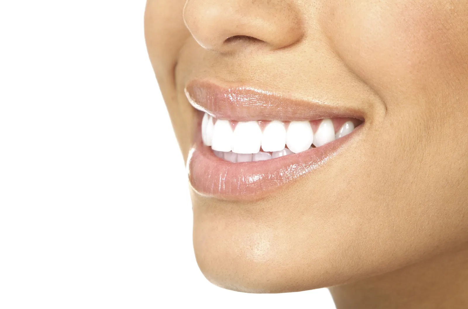 24968 ct teeth whitening confidence