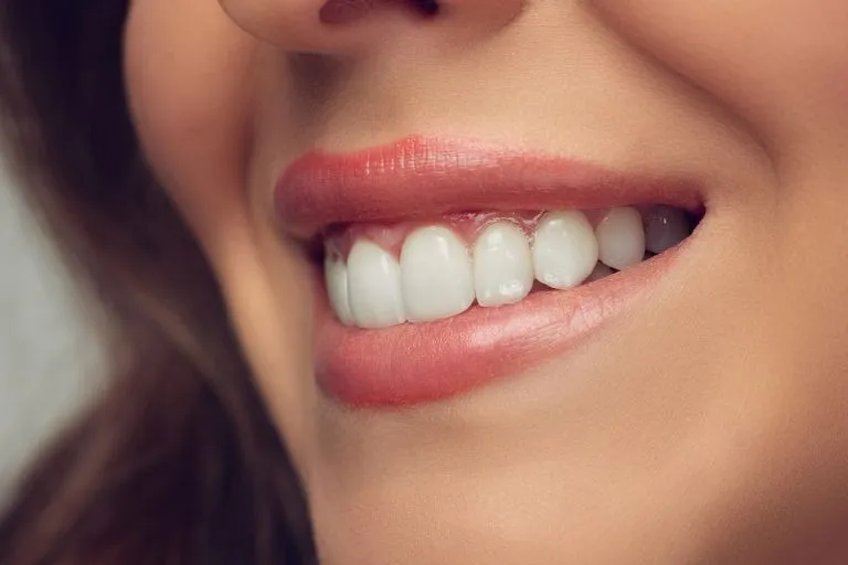 24970 choosing whitening method