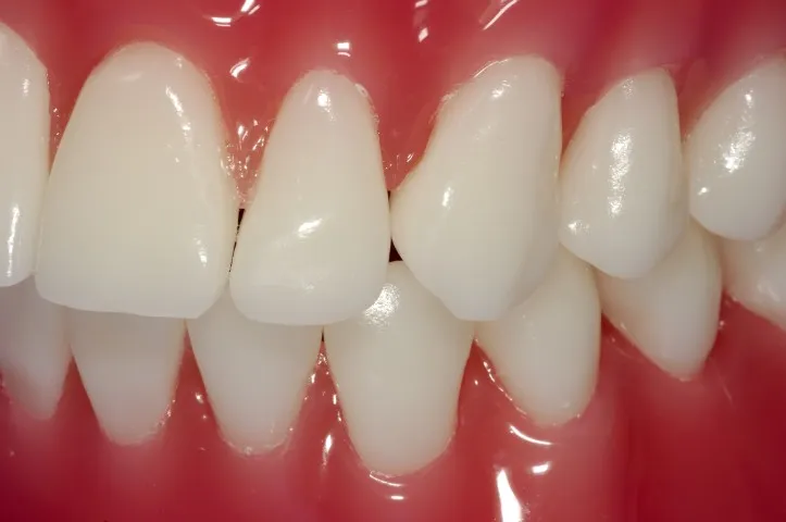 /img/24970-proper-oral-hygiene.webp