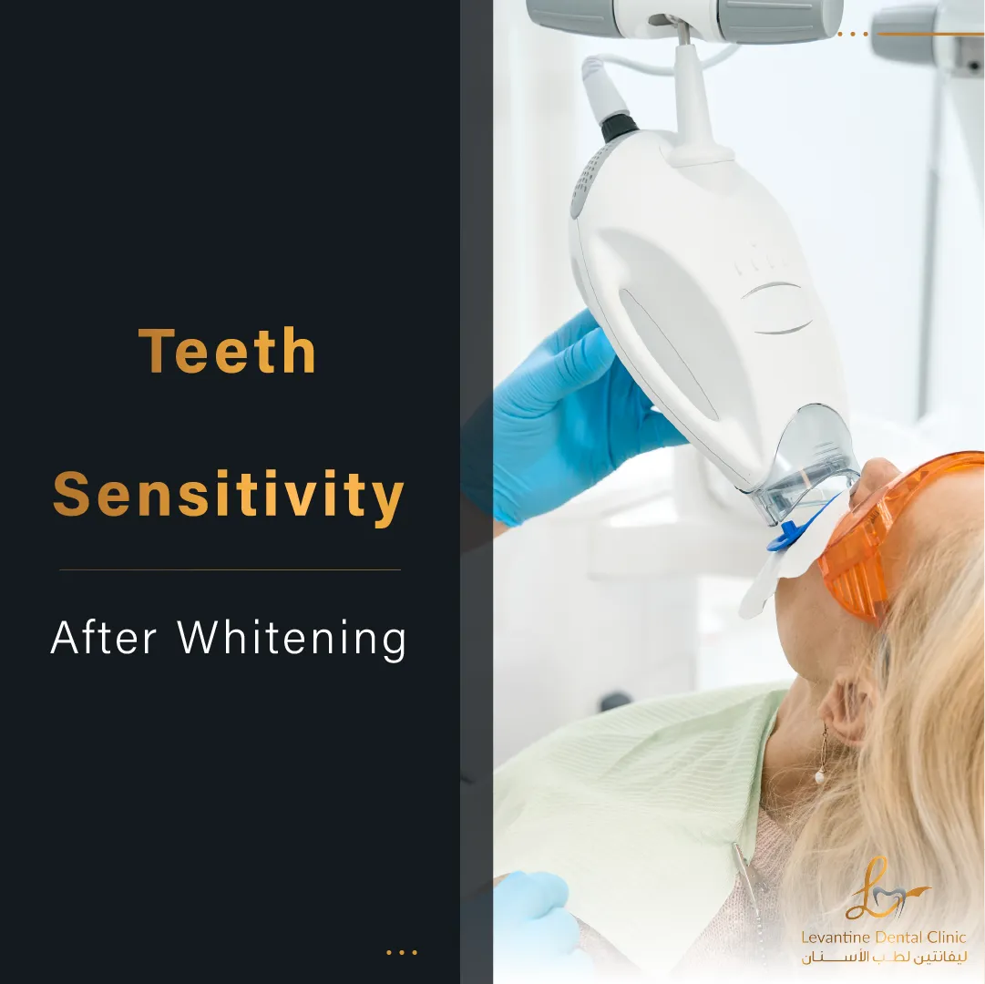 24977 teeth whitening sensitivity 5
