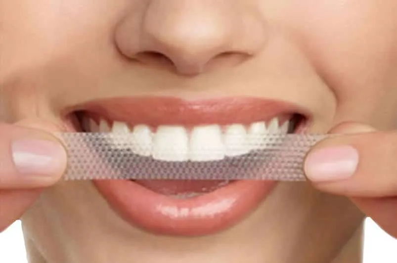 24978 teeth whitening process