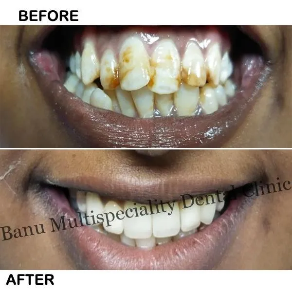 24984 bulimba dentist consultation