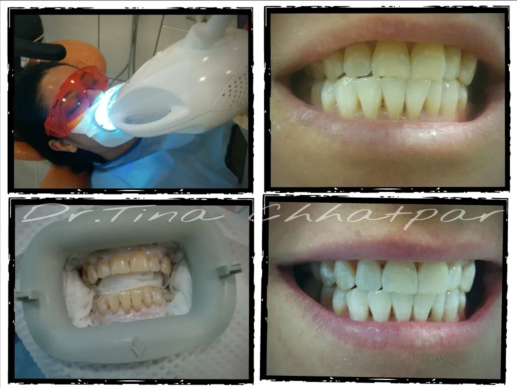 24984 oral hygiene routine