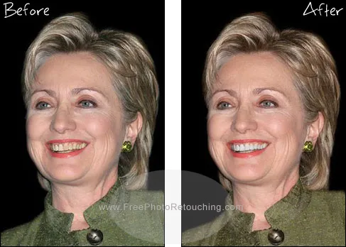 /img/24986-before-after-teeth-whitening.webp