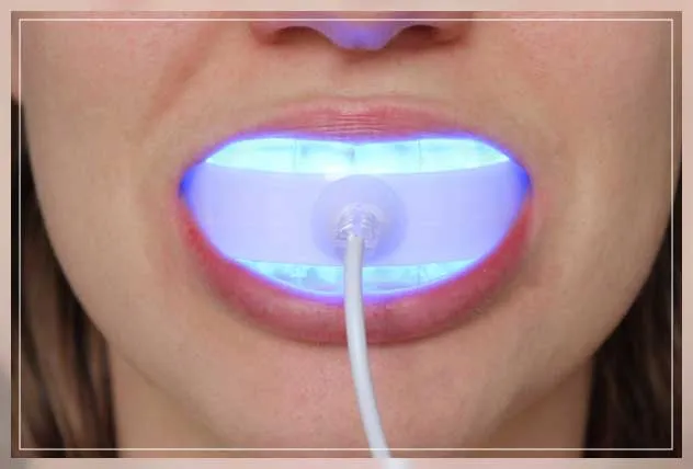 24990 hydrogen peroxide teeth whitening