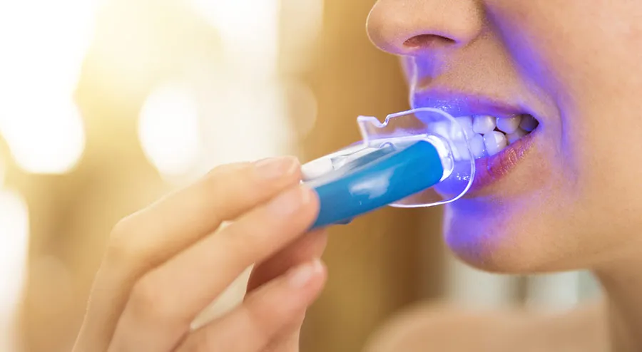 24990 sensitive teeth whitening