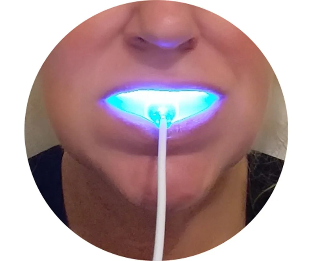 24990 teeth whitening overview