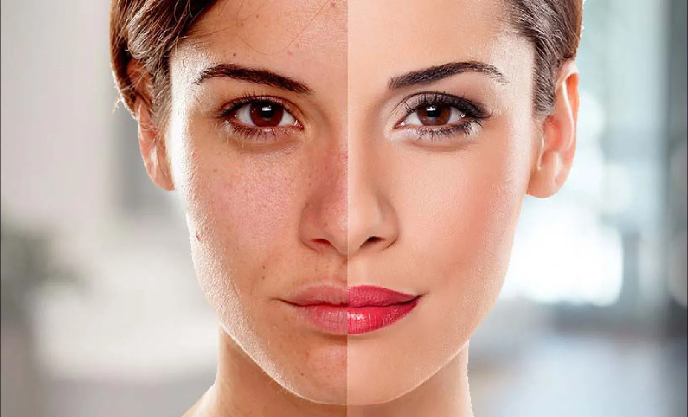 24993 genetics skin whitening
