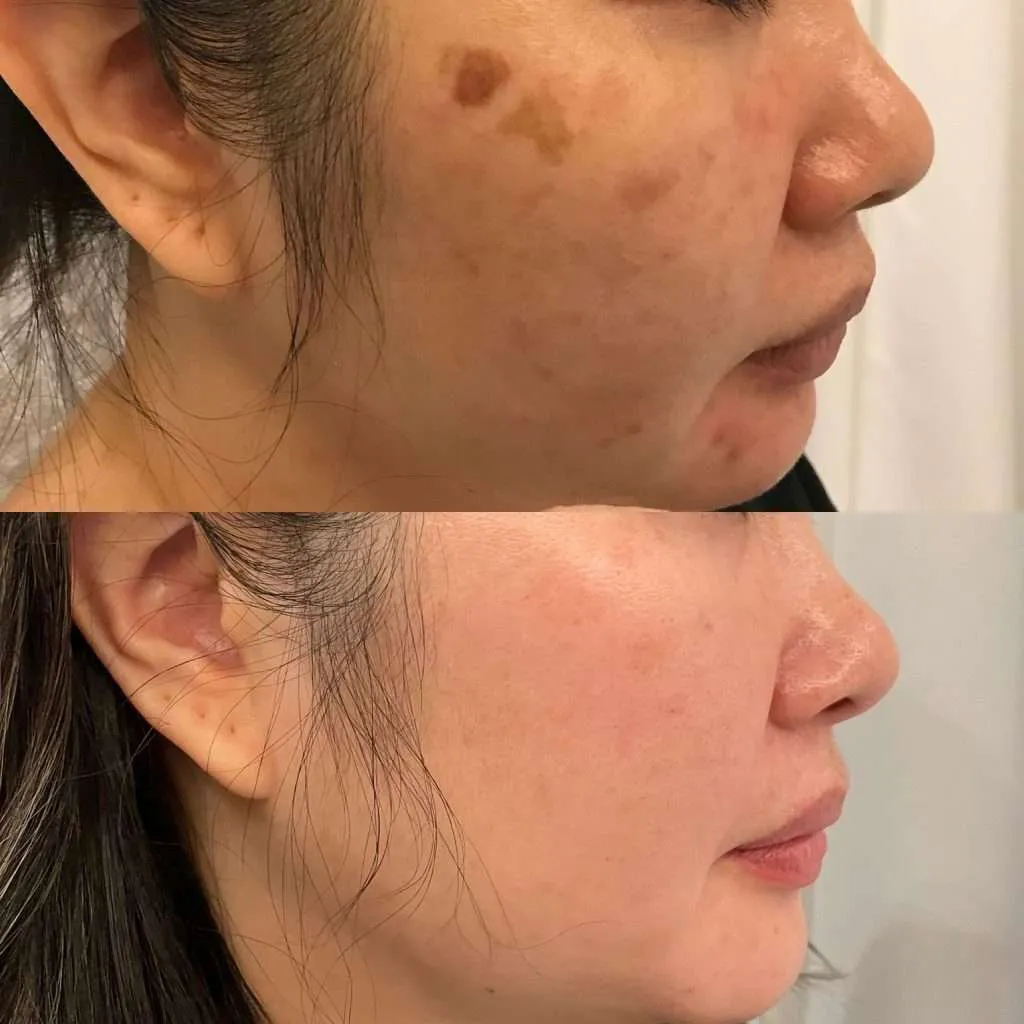 /img/24993-skin-whitening-healthy-diet.webp