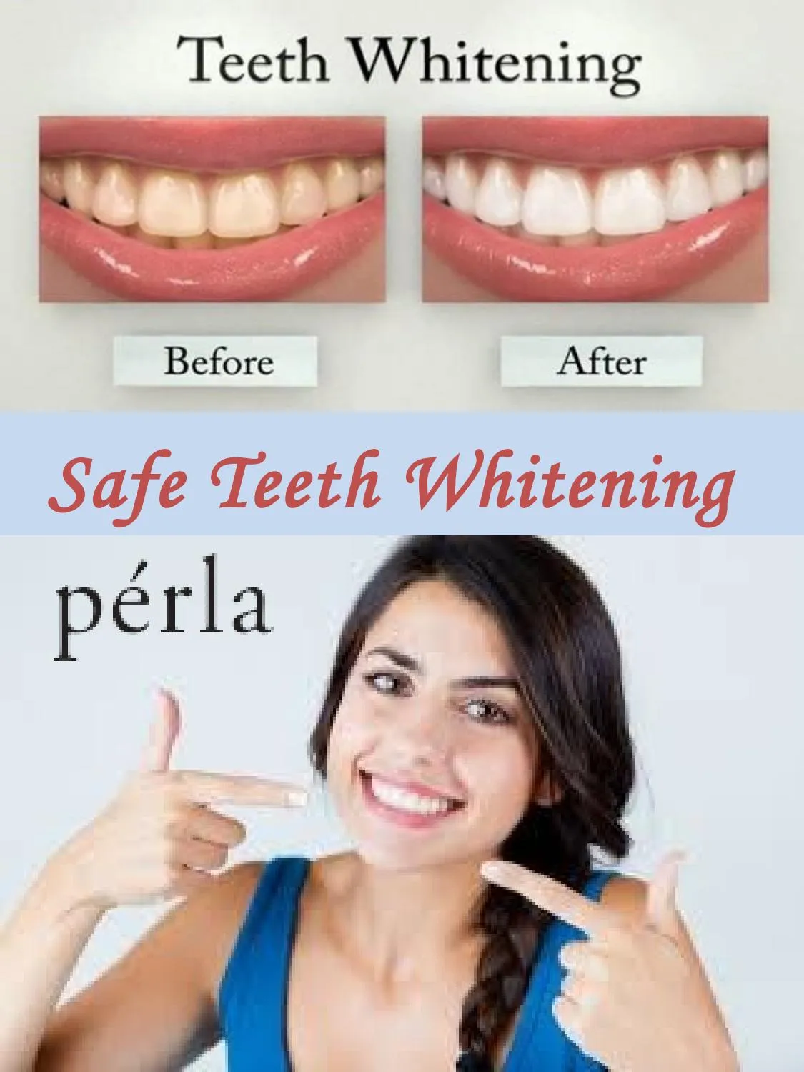 24995 teeth sensitivity treatment