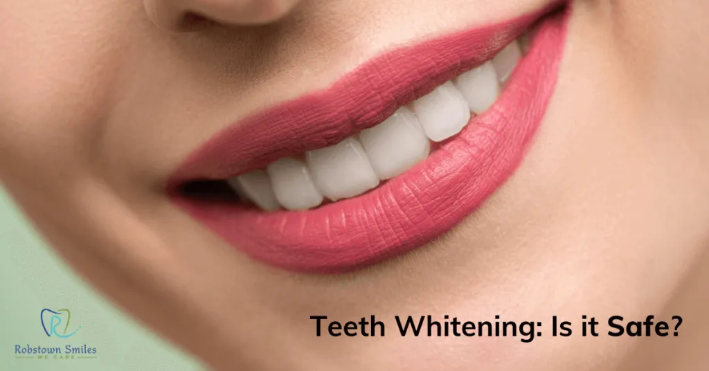 24995 teeth whitening maintenance