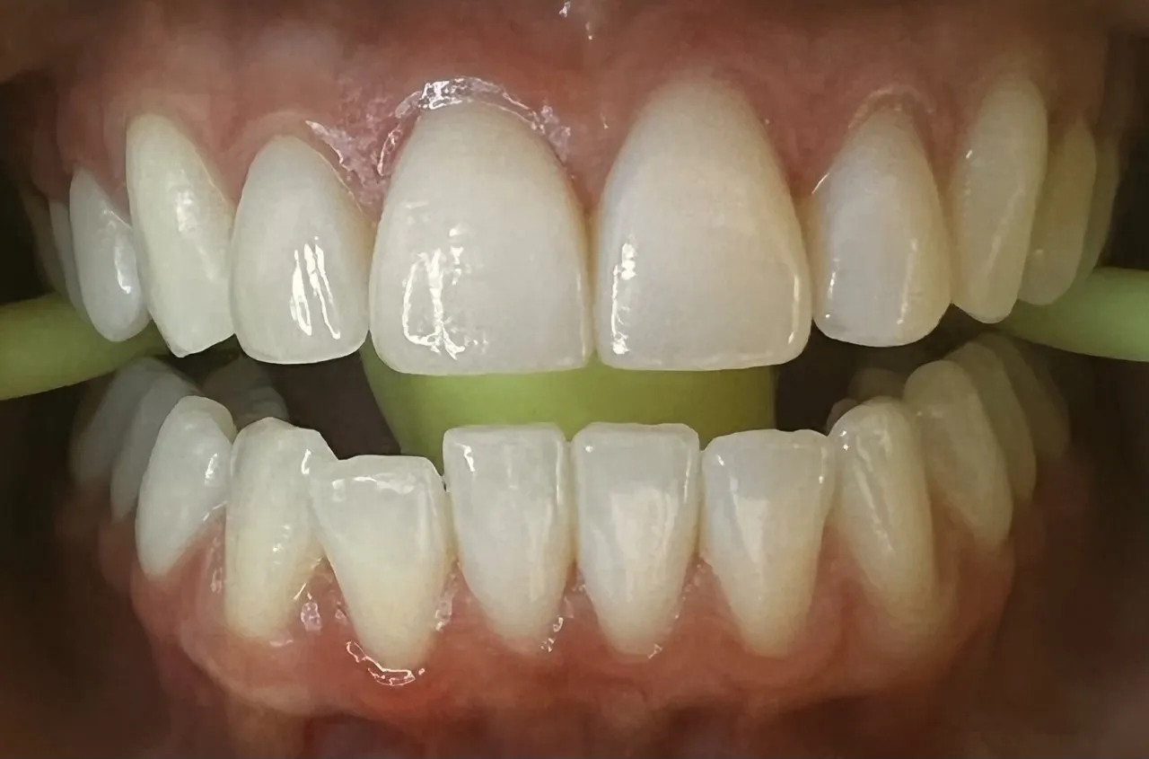 25004 dental checkup