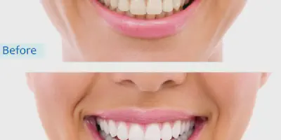/img/25004-smiling-woman.webp