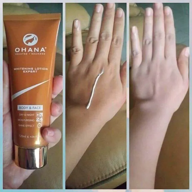 25005 ohana whitening lotion promotions