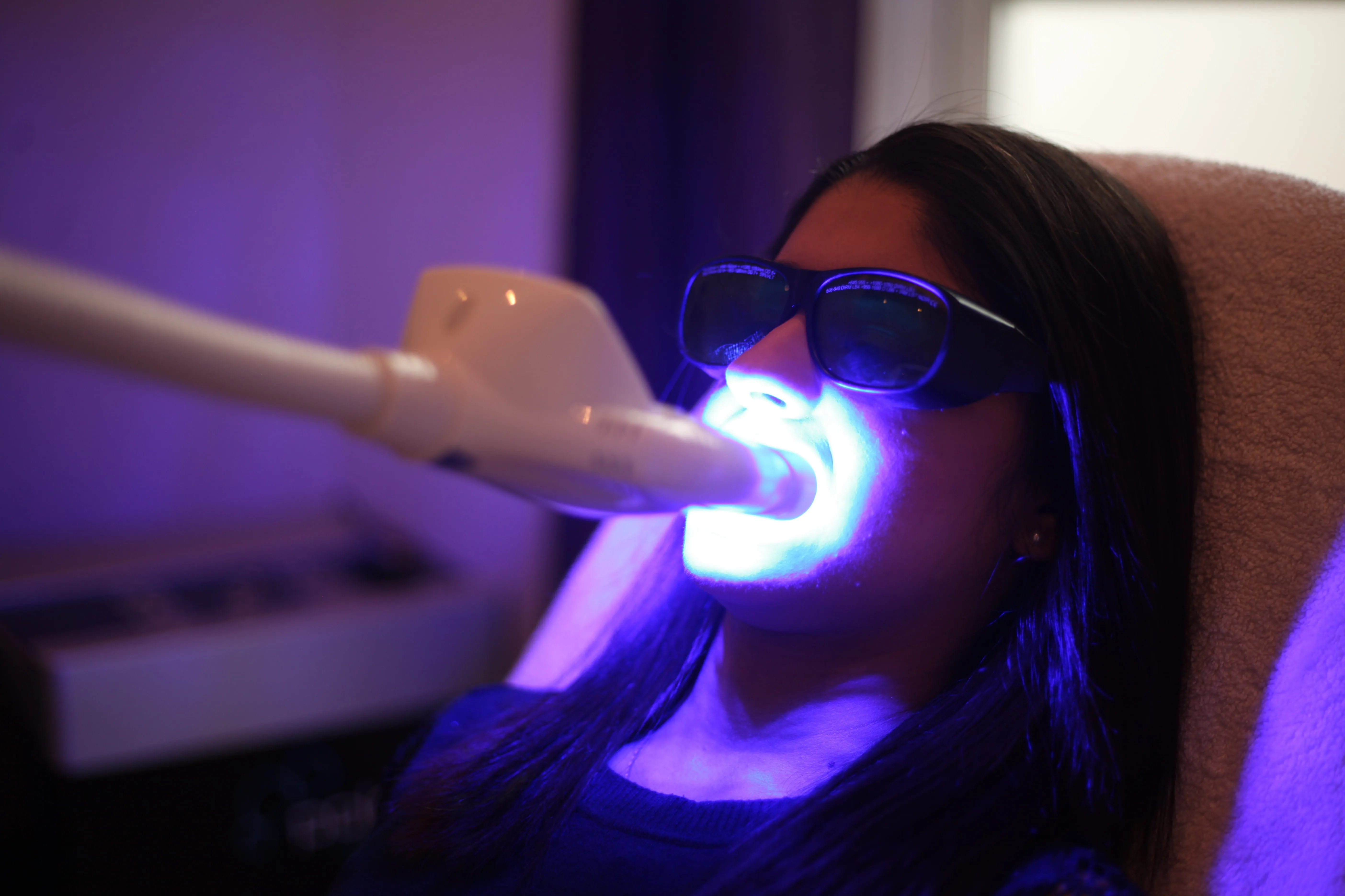 25011 teeth whitening surrey procedure