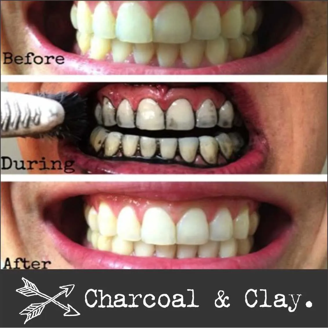 /img/25012-healthy-smile.webp
