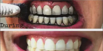 /img/25012-healthy-smile.webp