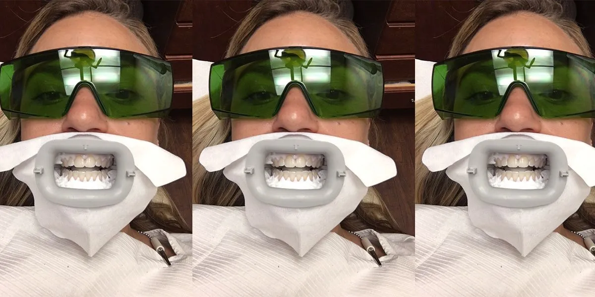 /img/25018-dental-checkup-after-whitening.webp