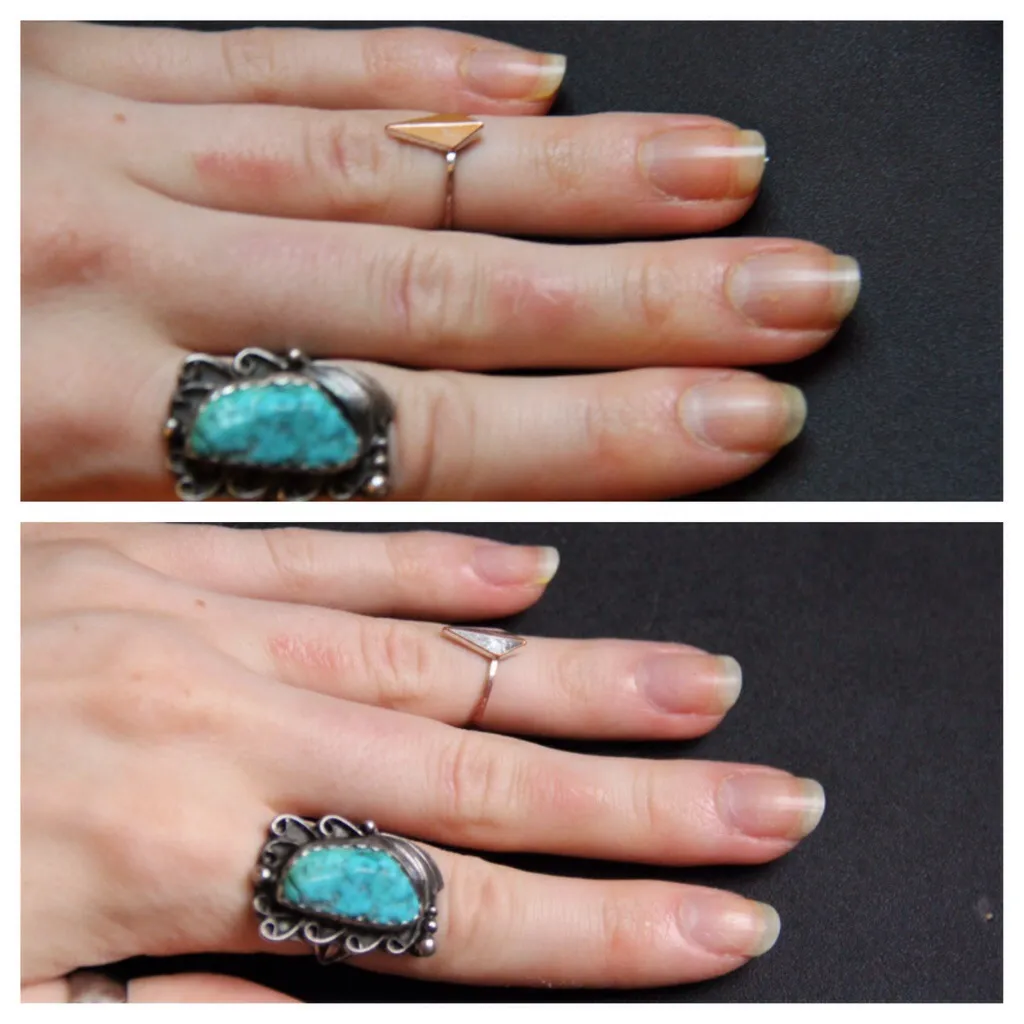 25025 apple cider vinegar nails