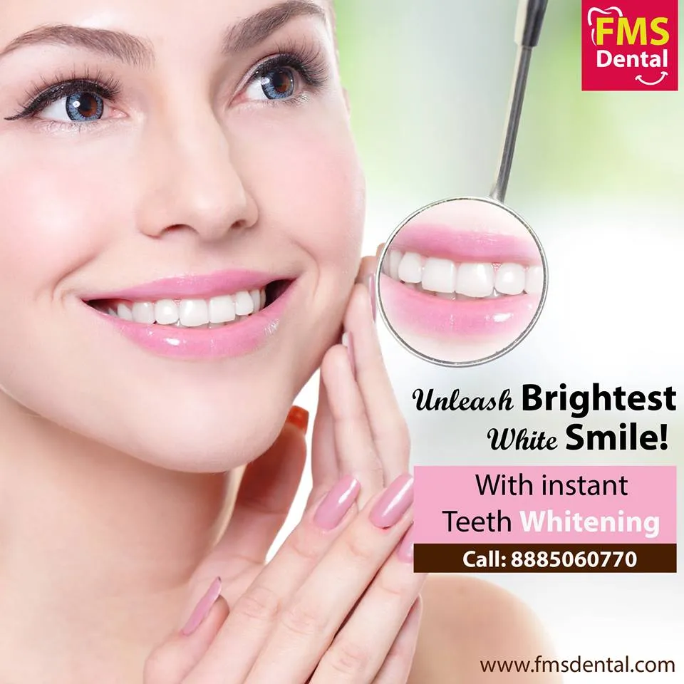 25033 in office teeth whitening